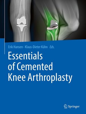 cover image of Essentials of Cemented Knee Arthroplasty